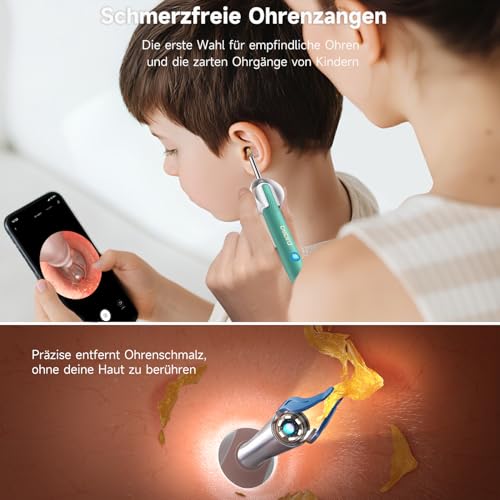 Image of BEBIRD R1 Ultra Ear Wax Removal, Ear Cleaner with Camera Ear Scope, Wax Remove Ear Pick with Ear Otoscope Tweezers, Visual Dropper Cleaning Kit, Ear /Nose /Throat Examination Tool for Family, Green