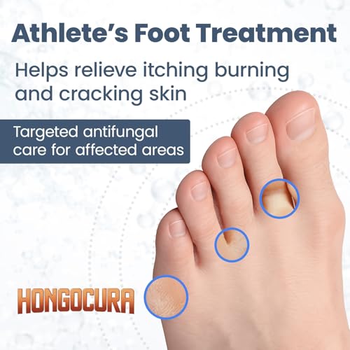 Image of Antifungal Cream for Athlete's Foot - Relieves Itching, Cracking & Redness, Fast-Acting Skin Ointment for Jock Itch & Ringworm - Non-Greasy & Absorbs Quickly - 20 gm | 1-Pack