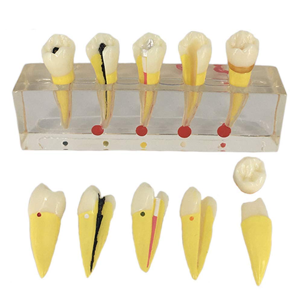 Dentiste de Formation modèle d'enseignement à communiquer avec Les Patients modèle Dentaire modèle Dentaire de la résine de démonstration Dentaire
