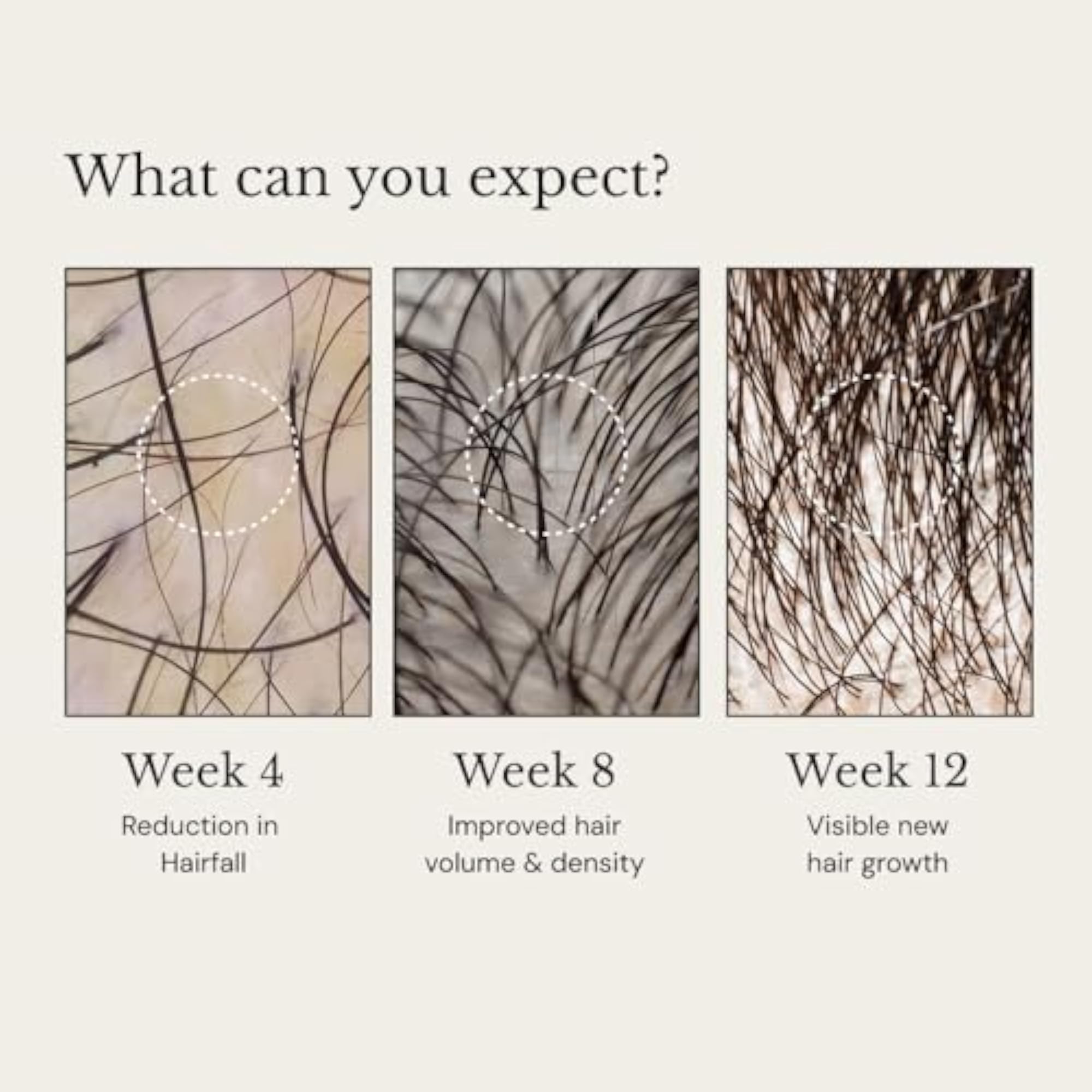 Anagrow® Advanced Hair Regrowth Serum, Swiss Formula