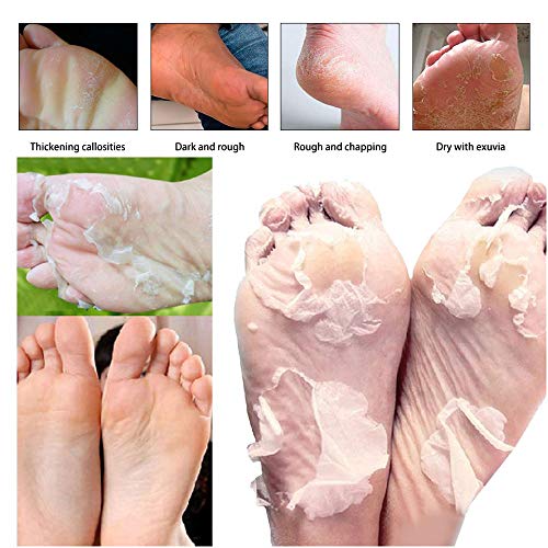 Foot Peel Mask 5 Pack,Rose Exfoliating Foot Masks, Soft Smooth Touch Natural Exfoliator For Dry Dead Skin, Callus, Repair Rough Heels,Gifts For Women Mom And Men #TOP5