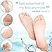 DERMORA Foot Peel Mask - 2 Pack of Regular Size Skin Exfoliating Foot Masks for Dry, Cracked Feet, Callus, Dead Skin Remover for Baby Soft Feet, Lavender Scent