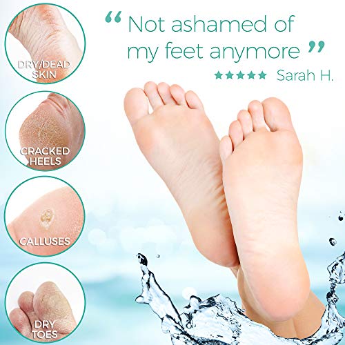 Peach Foot Peel Mask - 2 Pack - For Cracked Heels, Dead Skin & Calluses-Make Your Feet Baby Soft- Removes & Repairs Rough Heels, Dry Toe Skin-Exfoliating Peeling Natural Treatment