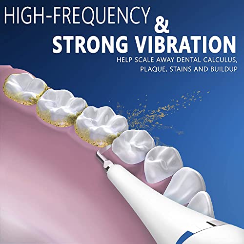 Ecardy Electric Dental Calculus Remover - Tartar Remover For Fighting Tartar - Tartar Scraper - Tooth Stains - Teeth Polishing #TOP2