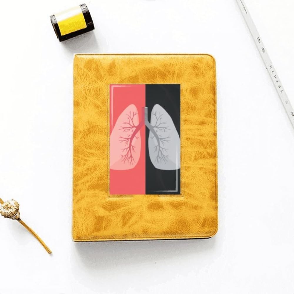 no/no Logo Lung Comparison Art Deco Fashion Photo Album Family Wedding Picture 4x6