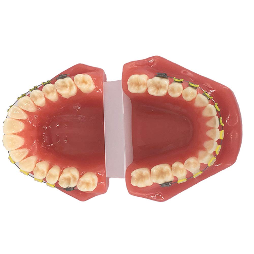 Model ortodontyczny zębów zębów z metalowymi i ceramicznymi modelem doustnym dla dentysty do komunikowania się z pacjentami, studiowanie narzędzia dydaktycznego