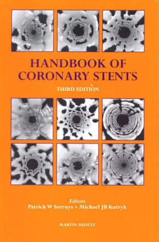 Handbook of Coronary Stents: Serruys, Patrick W.: 9781853173578: Amazon.com: Books