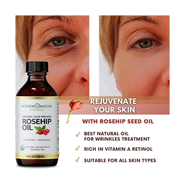Rosehip-Oil-USDA-Certified-Organic-100-Pure-Cold-Pressed-Unrefined-Carrier-Oil-for-Men-Women-4oz-Natural-Anti-Aging-Moisturizer-for-Face-Hair-Skin-Nails-Non-GMO Rosehip Oil - 100% Pure Organic Certified, Cold Pressed & Unrefined Carrier Oil For Face, Hair & Skin, Great For Fine Lines, Wrinkles & Facial Oil (4 Oz)
