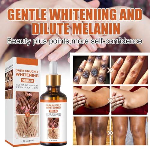 Grgowe 2Pcs Coudes Sérum Éclaircissant,Sérum Éclaircissant Pour Les Articulations,Sérum Blanchissant Pour Les Articulations,Dark Knuckle Whitening Serum,Pour Les Aisselles,Les Coudes,Les Genoux – vue 3