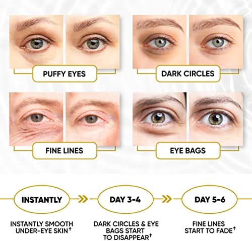 24k Gold Eye Masks for Puffy Eyes and Dark Circles - Anti-Aging, Moisturizing Effect - Under Eye Patches with Collagen, Hyaluronic Acid for Eye Bags, Fine Lines, Wrinkles - Under Eye Masks, 30 Pairs