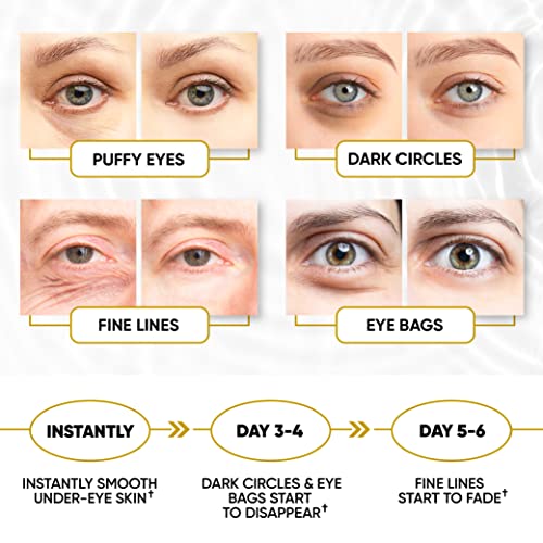 Under Eye Patches - 24K Gold Under Eye Mask For Puffy Eyes, Dark Circles, Eye Bags, Puffiness, Wrinkles, With Collagen - Anti Aging Skincare Eye Patch Treatment Masks - Hydrating Golden Under Eye Gel Pads #TOP5