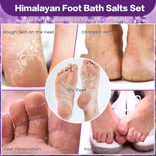 https://m.media-amazon.com/images/I/516Bf-Uk1gL.jpg
