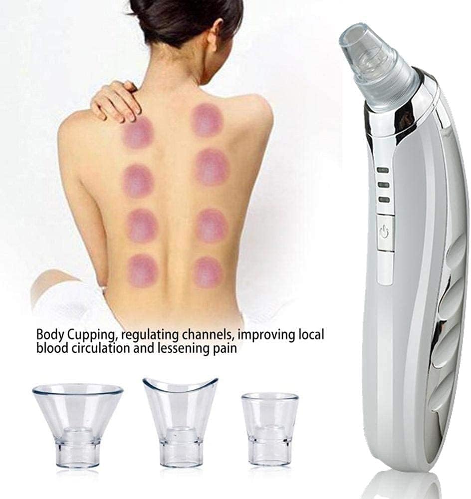 Blackhead Remover Vacuum,USB Rechargeable Facial Pore Cleaner Blackhead Suction Tool,Strong Suction Rechargeable Lightweight Pore Cleaner (Color : White)