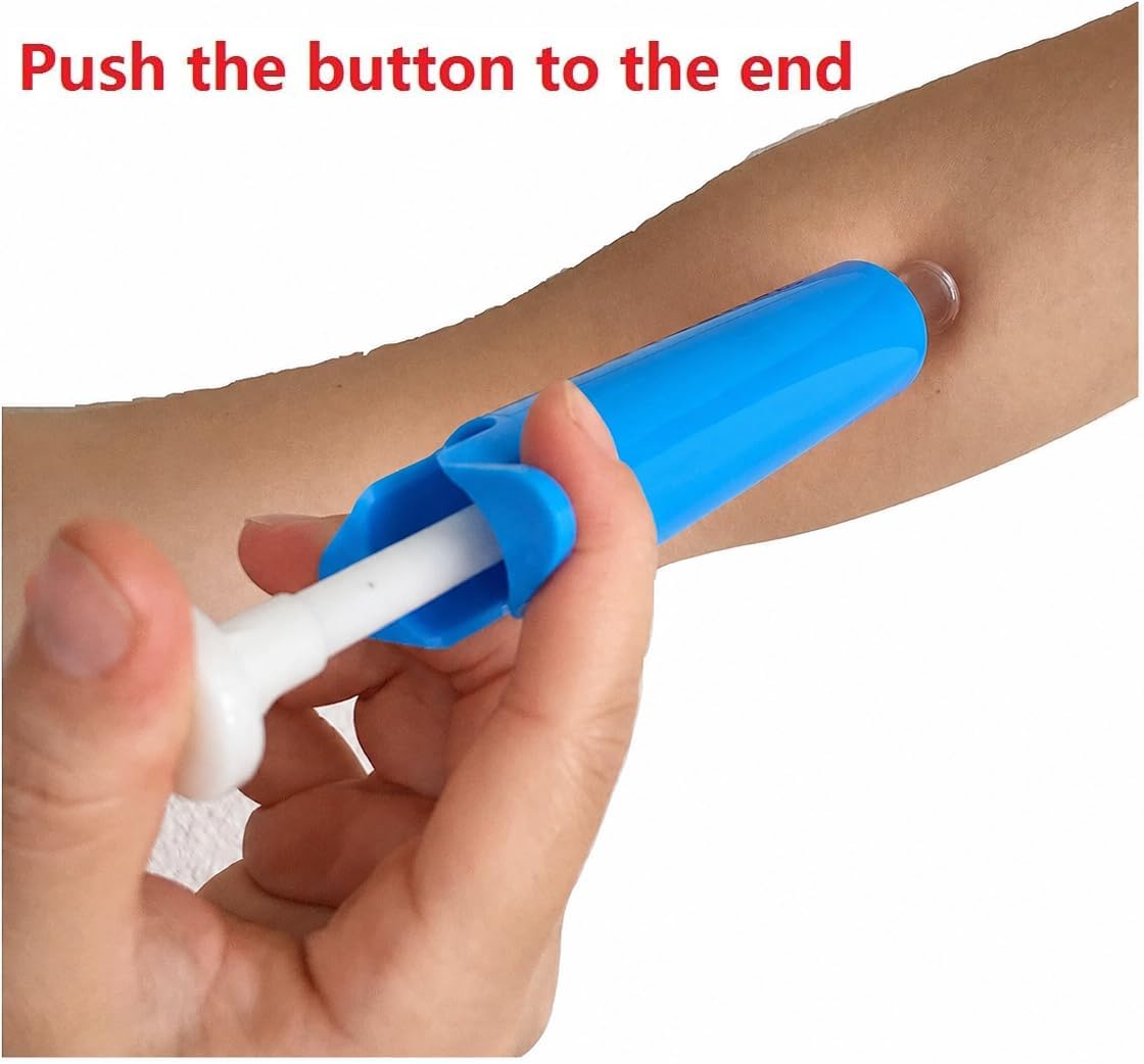 Insect Bug Bee Sting Snake Bite Venom Extractor Suction Kit Tool Pump First Aid Safety Fast Emergency for Hiking Backpacking Camping Blue and Case