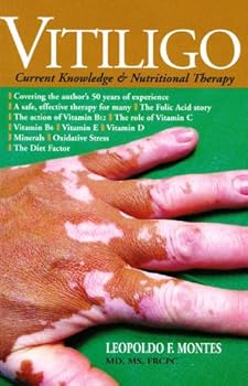 Paperback Vitiligo: Current Knowledge & Nutritional Therapy Book