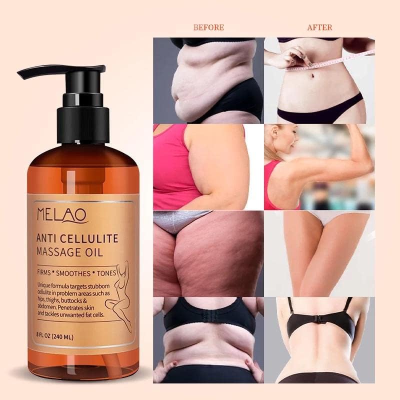 Miniatura 2 de Melao - Aceite de masaje anticelulítico que ayuda a tensar las estrías del tono, tratamiento removedor de celulitis reafirmante de la piel, 8 onzas