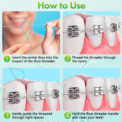 Floss Threaders, Orthodontic Threader, Ultraclean Access Tool for Maintaining Oral Health with Braces, Bridges, and Implants 250 Count