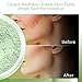 GREEN CORRECTOR (5 gram Sample Size Jar) Powder for Redness, Acne, Rosacea, Blemishes – Mineral Makeup Jar – Concealer, Noncomedogenic, Full Coverage Color Corrector for Sensitive Skin SPF 20