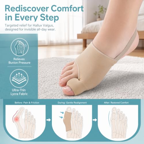 Bunion Corrector for Women and Men, Toe Straightener and Alignment Support — view 2