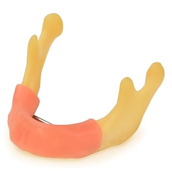 Ultrassist Mandible with Soft Tissue for Drilling Practice, Basic Implant Training Model with Practice Soft Artificial Tissue, Great Dental Training Tooth for Dental Implant Practice