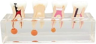 Global-Dental 4-Stage Endodontic Treatment Model for Studing Teaching Teeth Model #4003