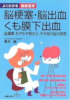 脳出血・くも膜下出血診療読本 Amazon.co.jp: 脳出血・くも膜下出血診療読本 : 豊田一則, 髙橋