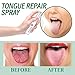 Tongue Relief Treatment Spray, Portable Reduce Soreness Eliminate Swelling Cleaning Tongue Repair Spray for Oral Health