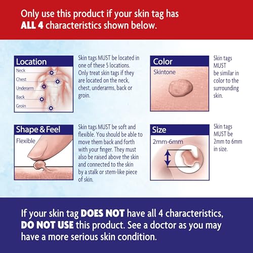 Alocane ALC03315 Precision Freeze, Skin Tag Remover thumb #3