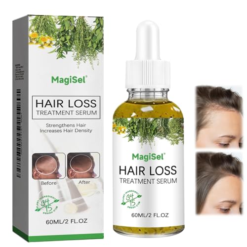 Sérum Cabello Hombres Mujeres, Crecimiento del Cabello, Aceite Hoja de Romero, Favorece Cabello, Suave No Graso, Hair Growth Serum para Cuidado del Crece pelo y Fortalece Las Raíces del Hair, 60ml