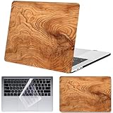 CARACTÉRISTIQUES du HOUSSE - conception de 2 pièces pour le cas d’ordinateur portable, facile sur facile off. Accès à tous les ports. Branchez le câble, le chargeur ou le casque sans retirer le boîtier. Boîtier inférieur ventilé pour une dissipation thermique maximale. Quatre pieds caoutchoutés pour garder votre ordinateur portable stable et sécurisé