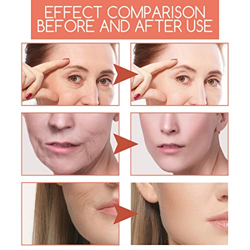 Rose Black Tea Squalane Essential Oil, Rose Oil Essential Oil, Anti-Aging Anti-Wrinkle Serum Moisturising Facial Oil, Squalane Essential Oil For Face&Body (1Pcs) #TOP4