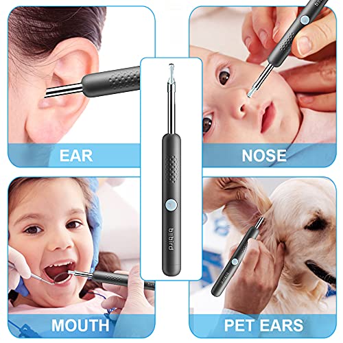 Ear Wax Removal,Earwax Remover Tool with 1080P FHD Wireless Wfi Ear Camera and 6 LED Lights,Visual Waterproof Ear Cleaner for iPhone, iPad & Android Smart Phones, with Ear Pick Ear Cleaning Kit