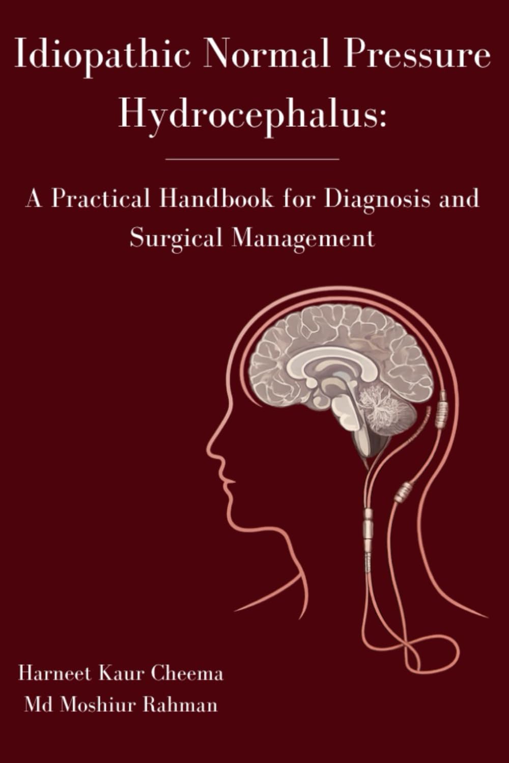 Idiopathic Normal Pressure Hydrocephalus: A Practical Handbook for Diagnosis and Surgical Management