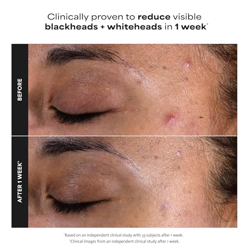 Paula's Choice SKIN PERFECTING 2% BHA Liquid Peeling - Gesichtspeeling mit Salicylsäure - Bekämpft Unreine Haut & Mitesser - Verkleinert Poren Sichtbar - Mischhaut, Fettige & Akne Haut - 118 ml