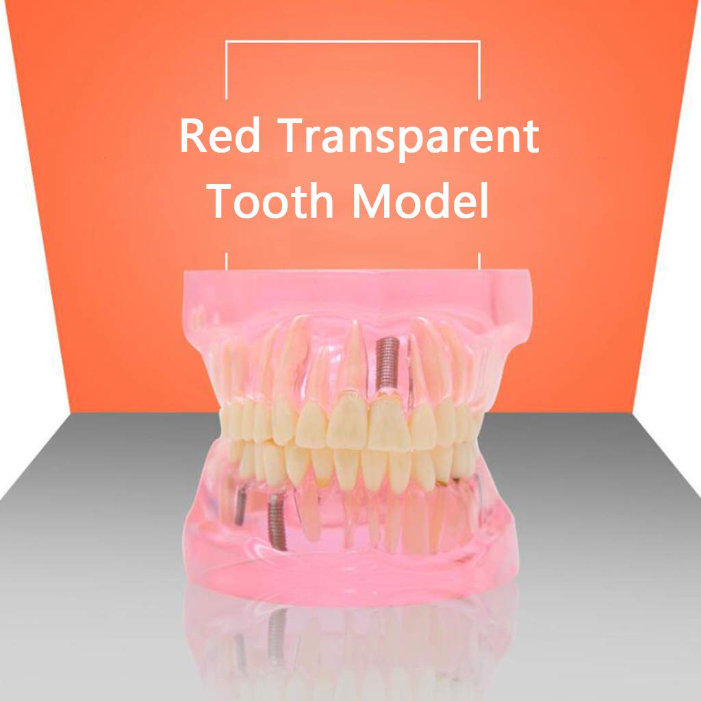 Modello Anatomico dei Denti - Modello di Dente per Addestramento alle Operazioni Ortodontiche Staccabili Trasparenti - per Aiuti allo Studio Educativo Medico, Attrezzature da Laboratorio