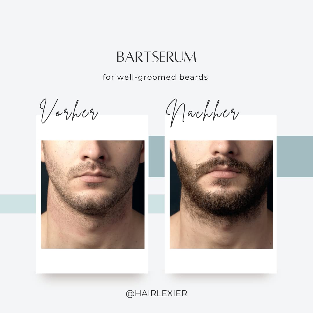 Bartserum • Natürliches WACHSTUMSELEXIER auf Öl basis für einen stärkeren, dichteren Bart - 12ML
