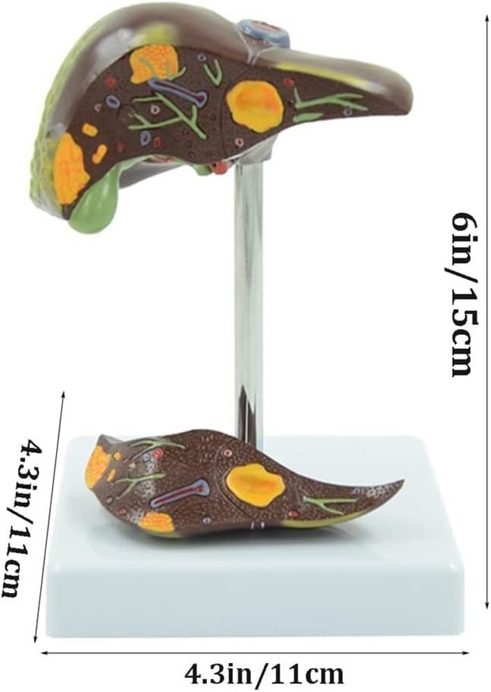 HEQIM Skeleton Models, Human Models, Life-Size Liver Anatomical Models, Pancreas Models for Medical Research and Teaching(2 Pack)