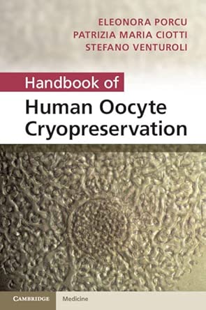 Handbook of Human Oocyte Cryopreservation book cover