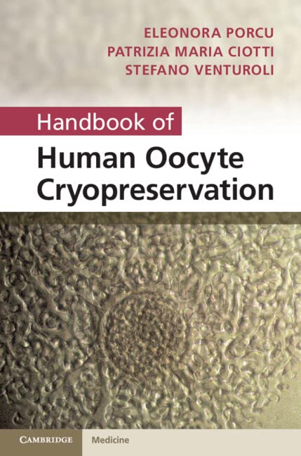 Handbook Of Human Oocyte Cryopreservation