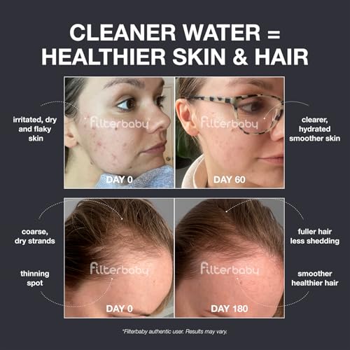 Image of Filterbaby Diamond Shower Filter for Skin & Hair, IAPMO Tested to NSF 177