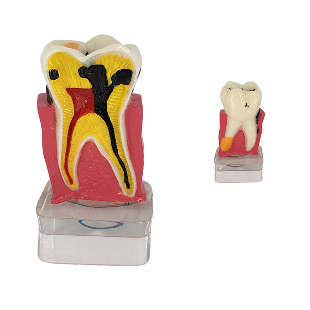 Sjdopulse Teeth Model, Oral Cavity Model, Nerve Quadruple Comprehensive Pathology Model