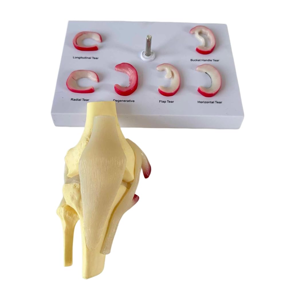 Modelo de articulación de Rodilla Humana Modelo de lesión de menisco Modelo de reparación de ligamento de Rodilla