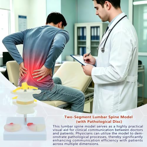 Image of 2 Section Lumbar Intervertebral Disc Human Skeleton Spine Model,Anatomical Vertebrae Model for Chiropractic,Patient Education Demonstration,Excellent Way for Demonstrating Disc