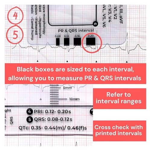 Règle ECG pour interpréter l'intervalle PR facilement sans erreur de lecture - 6