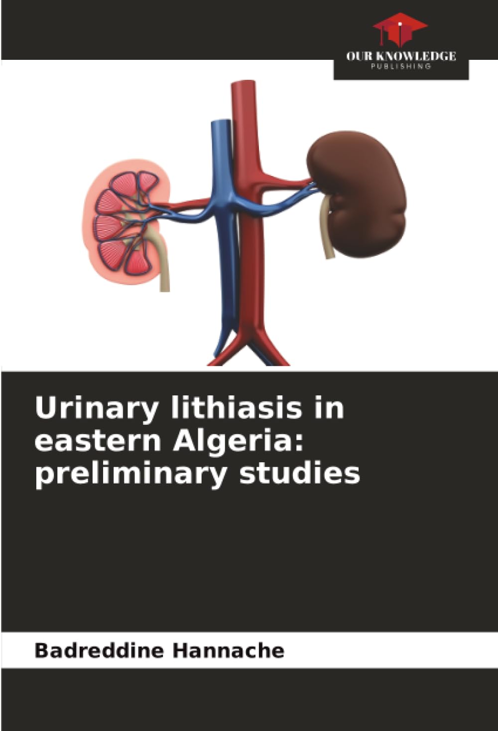 Urinary lithiasis in eastern Algeria: preliminary studies