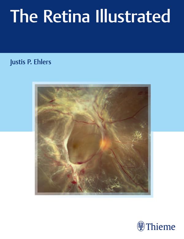The Retina Illustrated (English Edition)