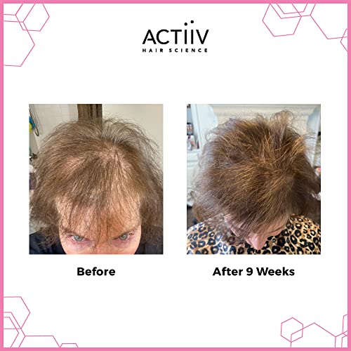 Actiiv Recover Thickening Cleansing Hair Loss Shampoo Treatment For Women, 6 Fl Oz #TOP2