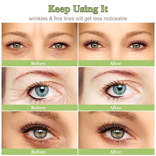 Remendos anti-rugas para os olhos 20pcs Tiras removedoras de rugas para suavizar as rugas dos olhos