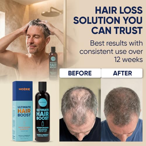 Moerie Ultimate Hair Growth Shampoo – dla dłuższych, grubszych, pełnych włosów – wegańskie, przyjazne dla skóry – bez parabenów i silikonu – wszystkie rodzaje włosów – odwrotne wypadanie włosów