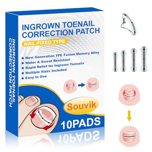 Souvik Eingewachsener Zehennägel Set, Nagelspange Fußnägel Nagelkorrekturspange 10Pcs, Zehennagel Eingewachsen-Heber Nagelpflaster für Männer, Frauen, Zehennägel Korrektur Patch, 17/18/19/20 mm